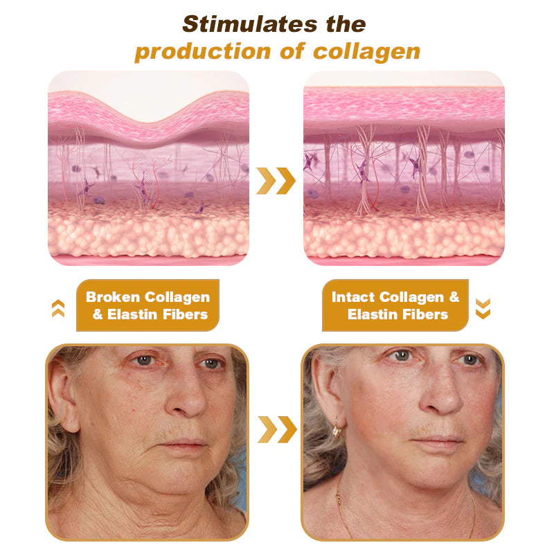 Botox Bee Venom Wrinkle Removal Cream