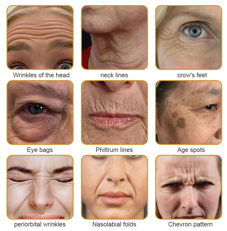 Botox Bee Venom Wrinkle Removal Cream