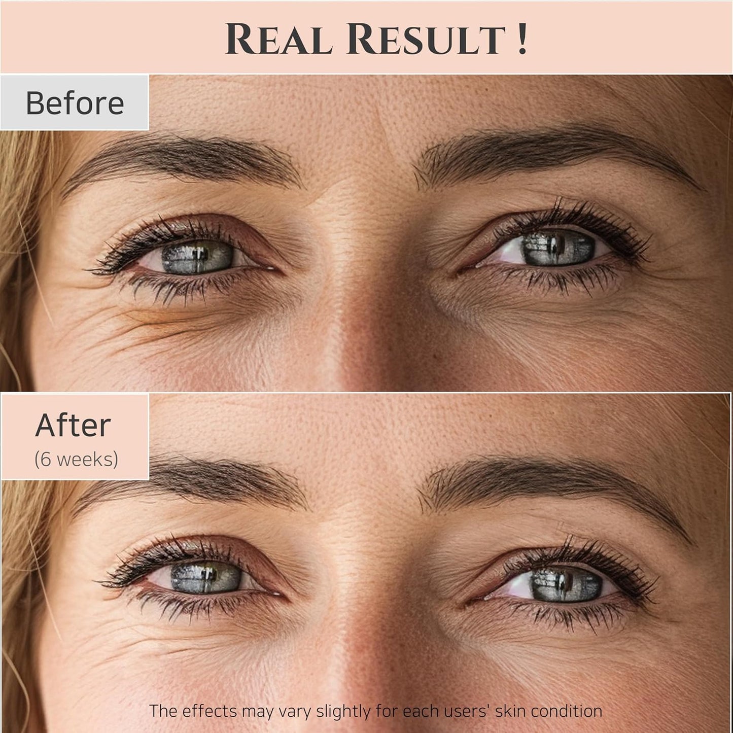 Revive Eye Serum – For Dark Circles, Fine Lines & Puffiness | 30ml