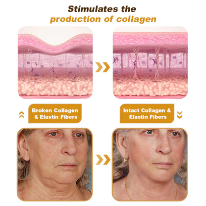Botox Bee Venom Wrinkle Removal Cream