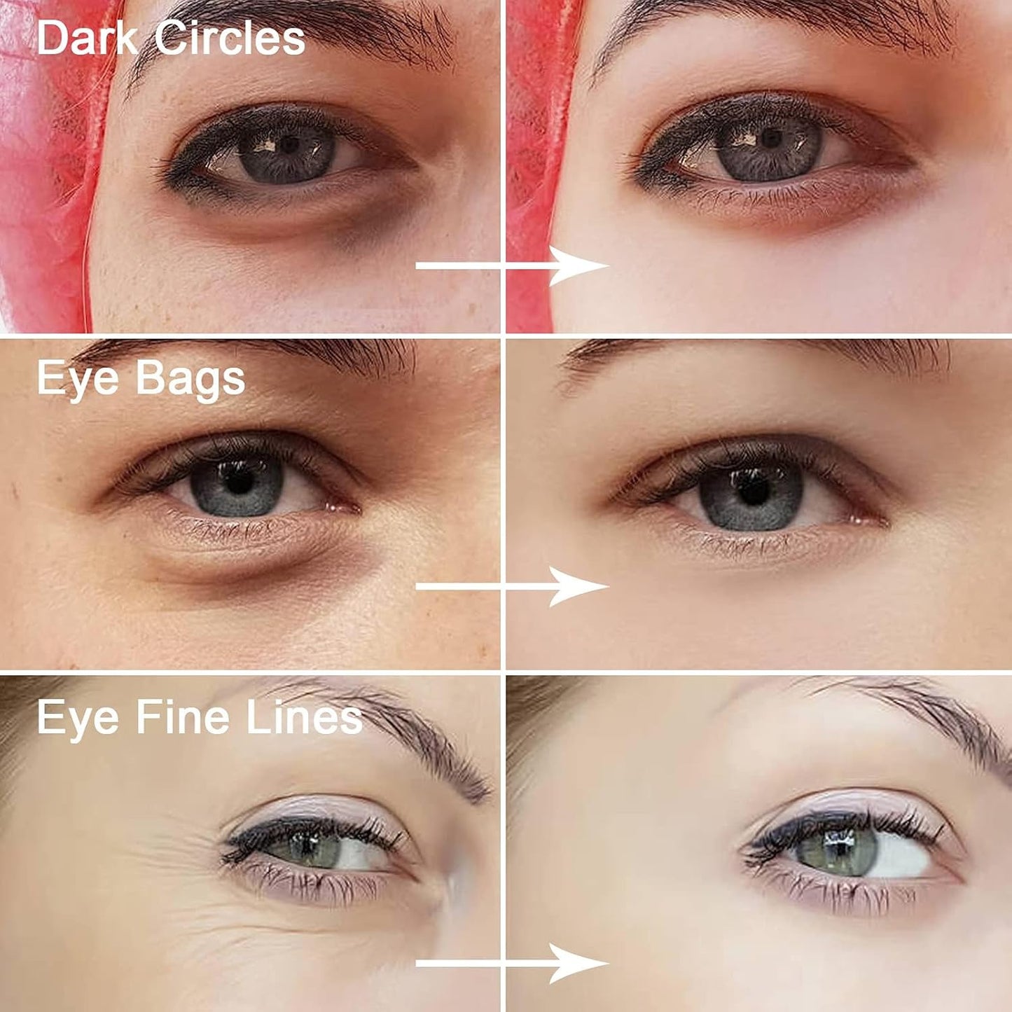 Dandy.7 Eye Serum – For Dark Circles, Puffiness & Fine Lines 30ml