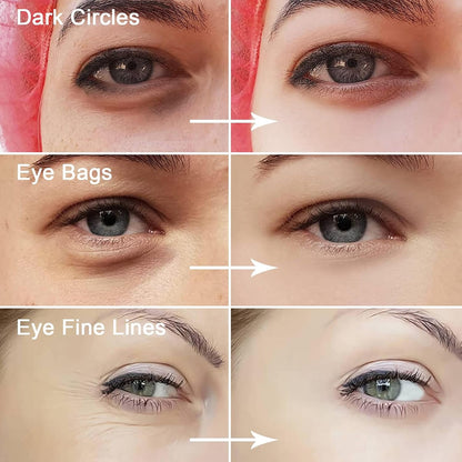 Dandy.7 Eye Serum – For Dark Circles, Puffiness & Fine Lines 30ml