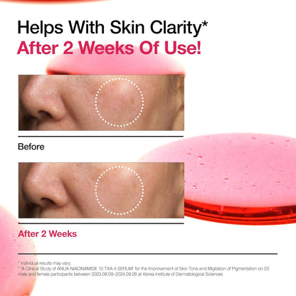 ANUA Niacinamide 10 + TXA 4 Serum (30ml)